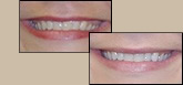before and after