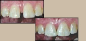 before and after