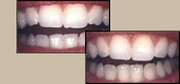 before and after