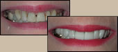 before and after