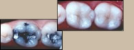 before and after